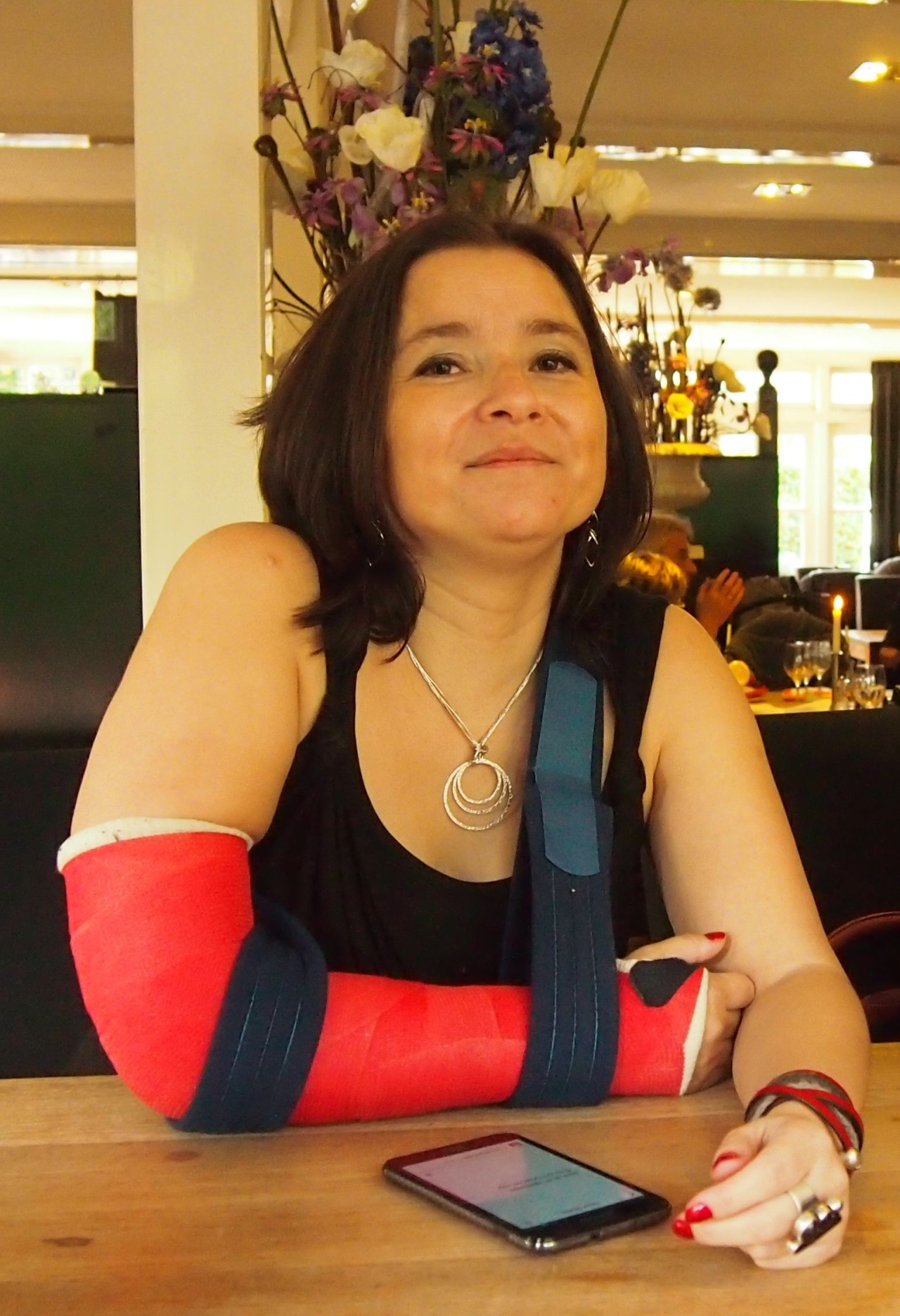 Biddy with her arm in a cast from bicep to fingers, arm resting in a sling